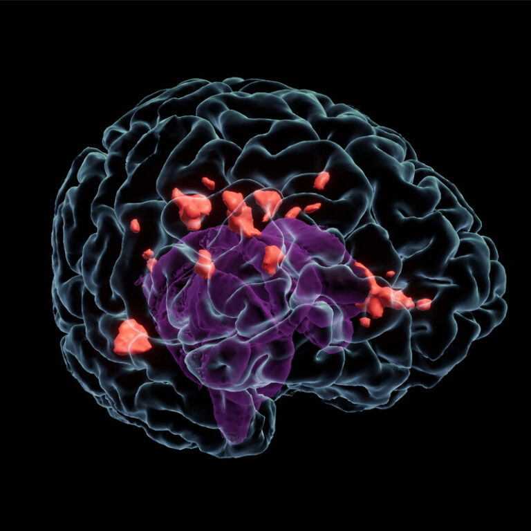 Patients – OctaveBio